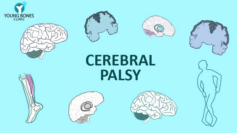 cerebral palsy: it is not a psychiatric disorder